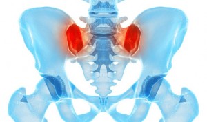 Exercise – The Best Treatment For Sacroiliac Joint Pain