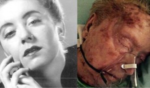 Former Model Rebecca Zeni eaten alive by scabies in Georgia nursing home